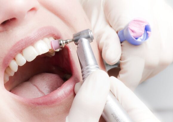 процесс ультрозвуковой чистки зубов