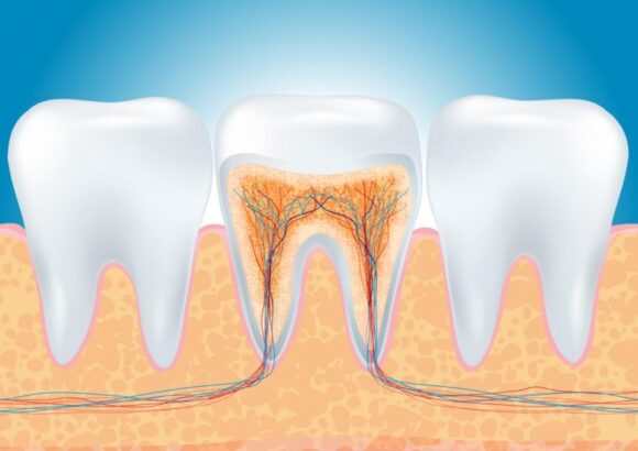 Воспаление корня зуба: лечение