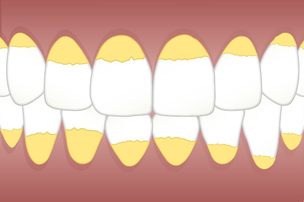 зубы желтого цвета